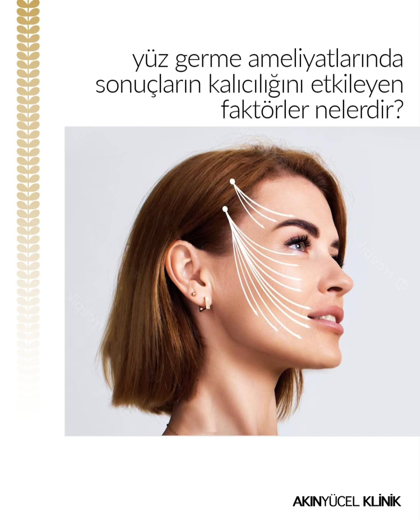 yüz germe ameliyatı